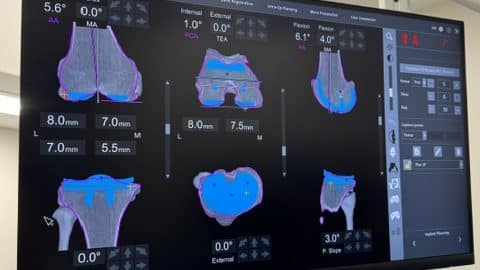 Premier Surgery Center Mako 2