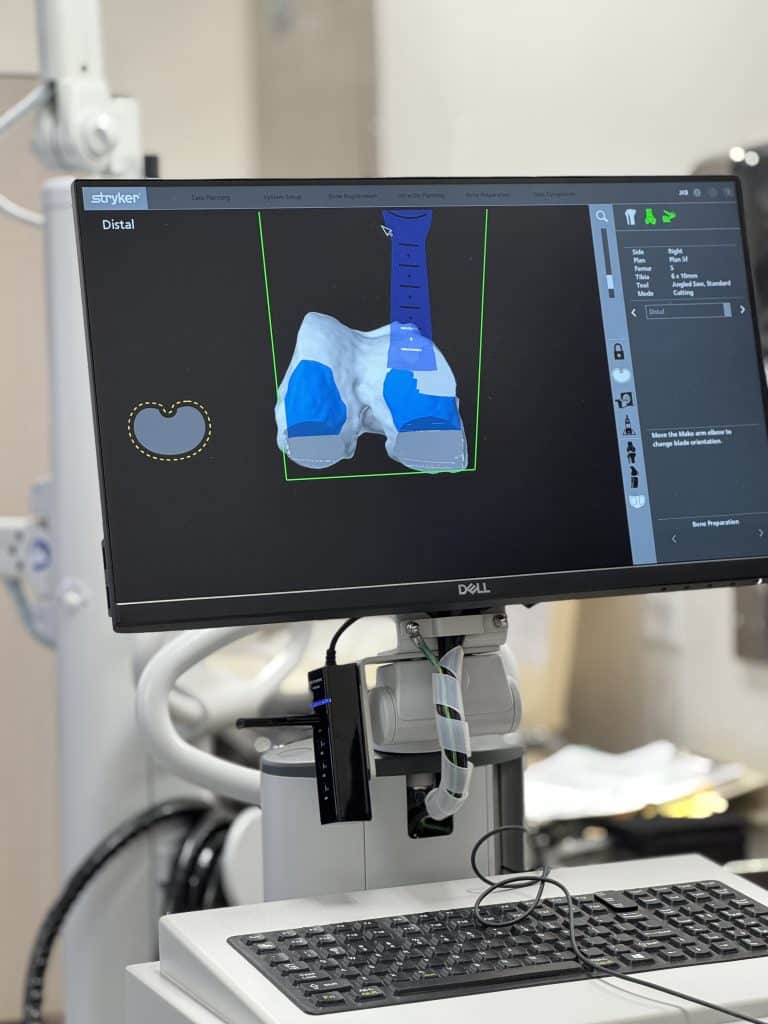 Premier Surgery Center Mako 4